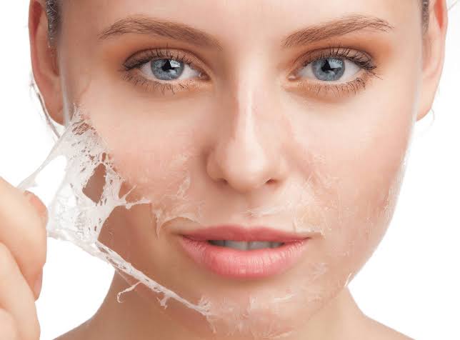 A Beginner's Guide to Chemical Peels: Master Peeling Depths & Safety